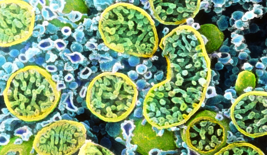 Mitochondria Aging