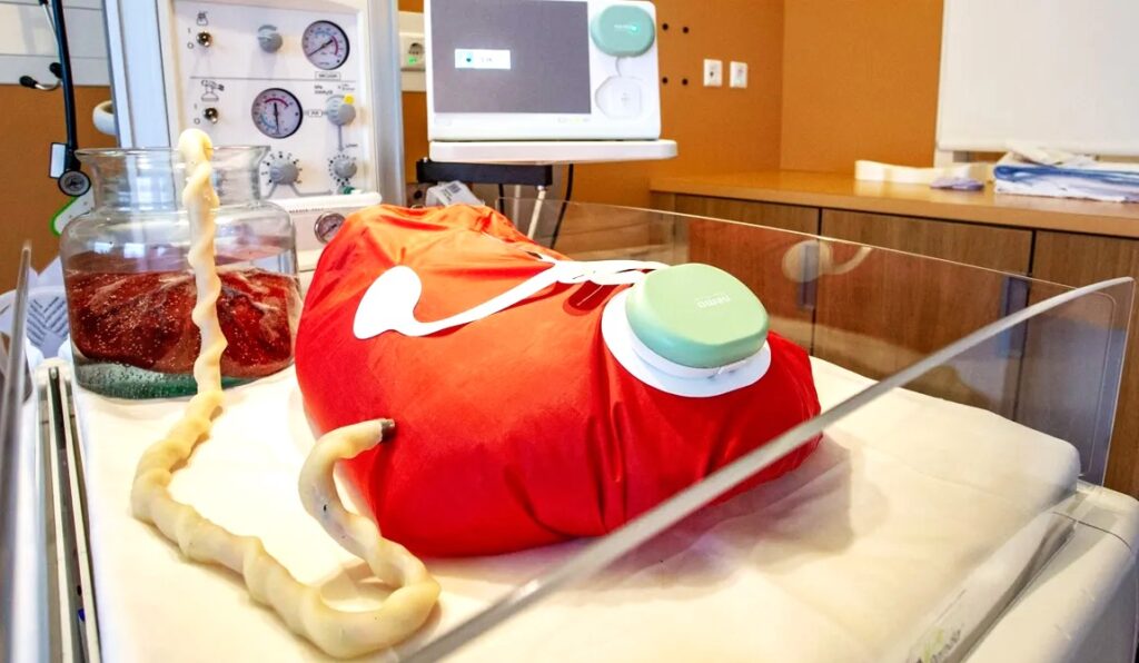 Ectogenesis Artificial Womb